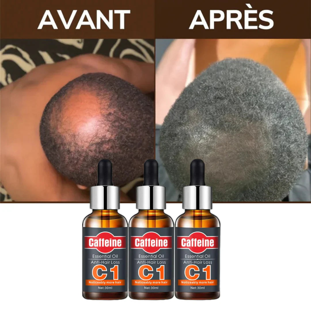 Huile de croissance rapide C1™ - Plus de perte de cheveux