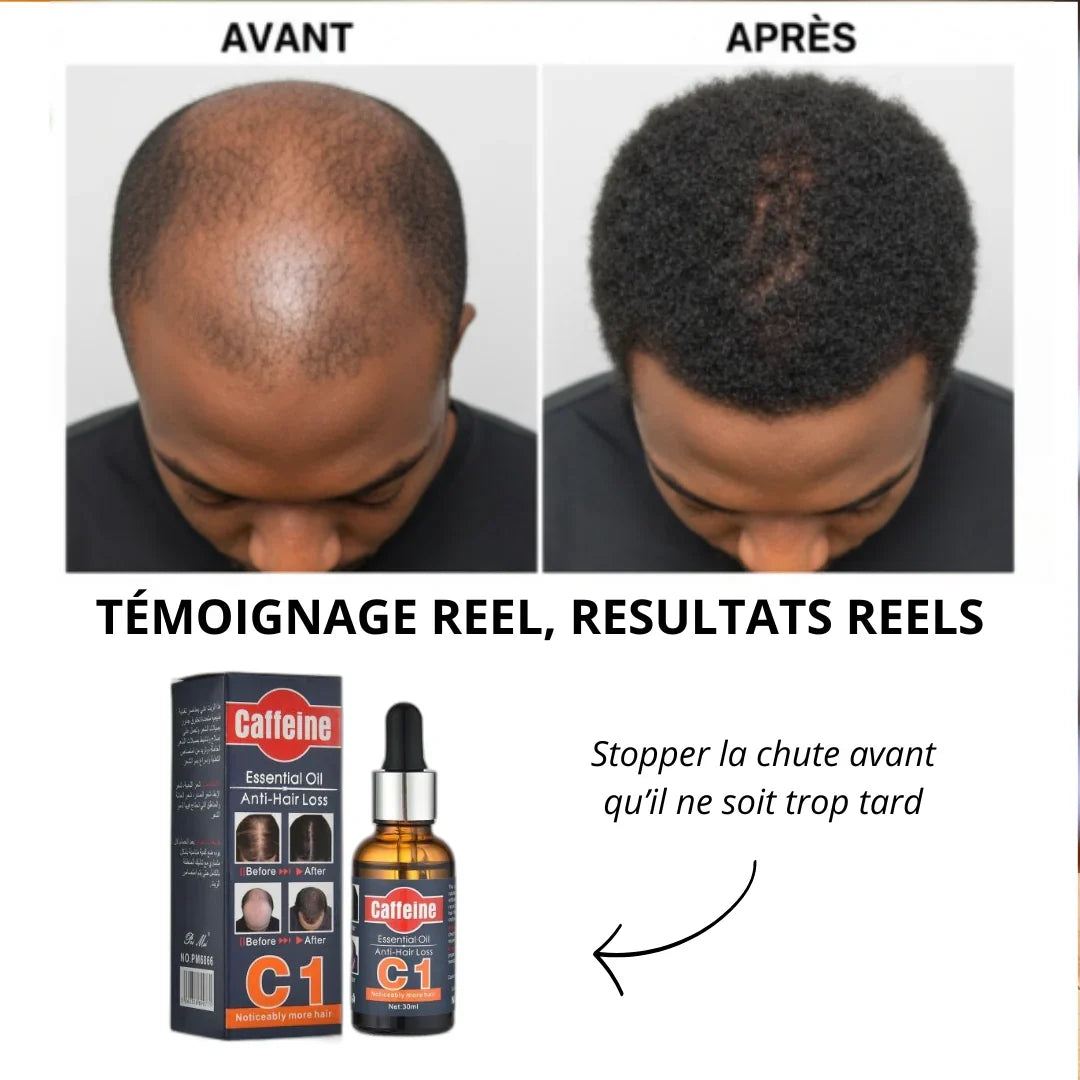 Huile de croissance rapide C1™ - Plus de perte de cheveux
